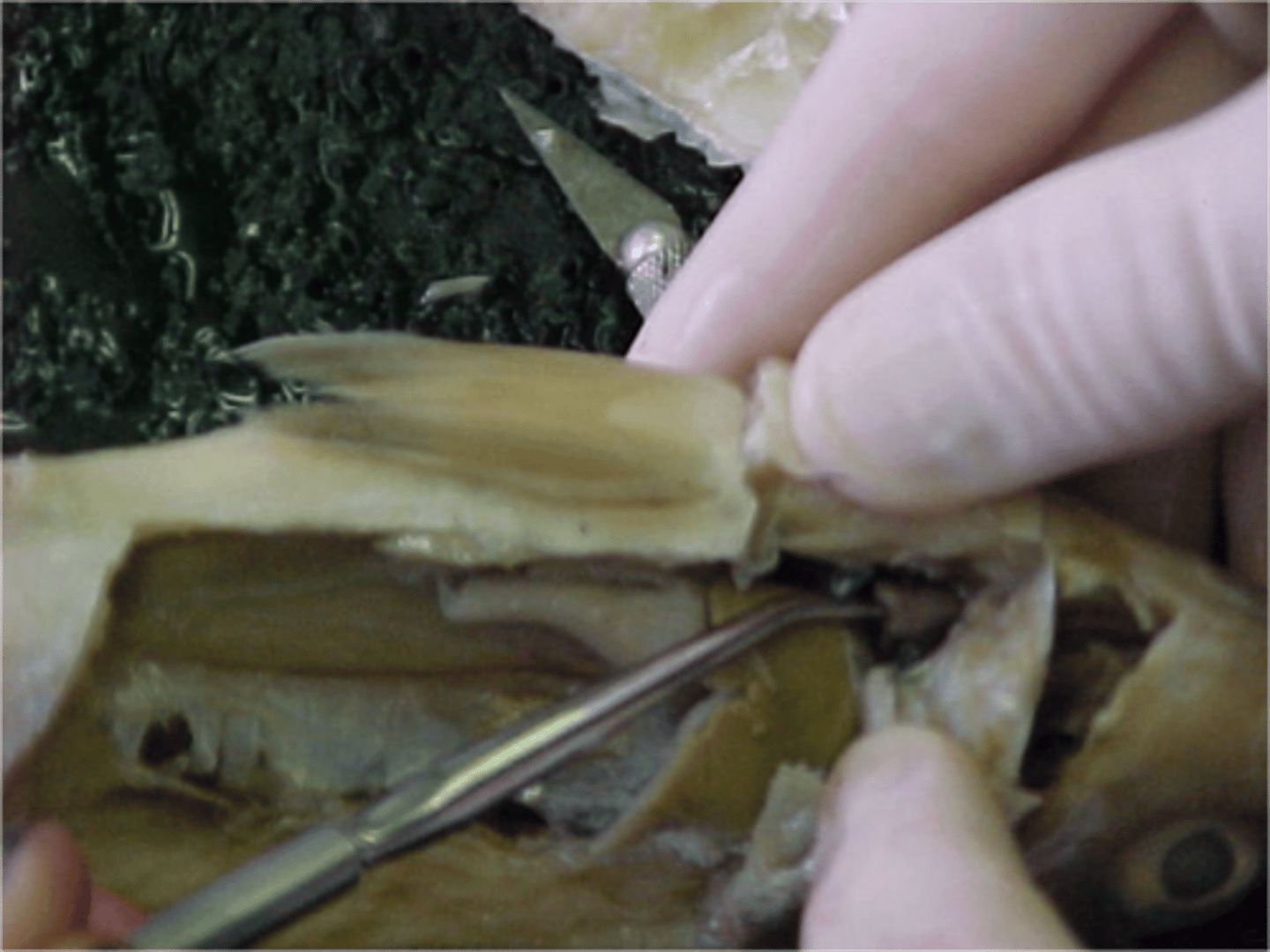 <p>A muscular two-chambered structure that pumps blood through the fish to exchange gasses</p>