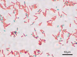 <p>Differential stain used to detect if a bacterial cell produced spores, must use steam to allow stains to penetrate the cells</p>