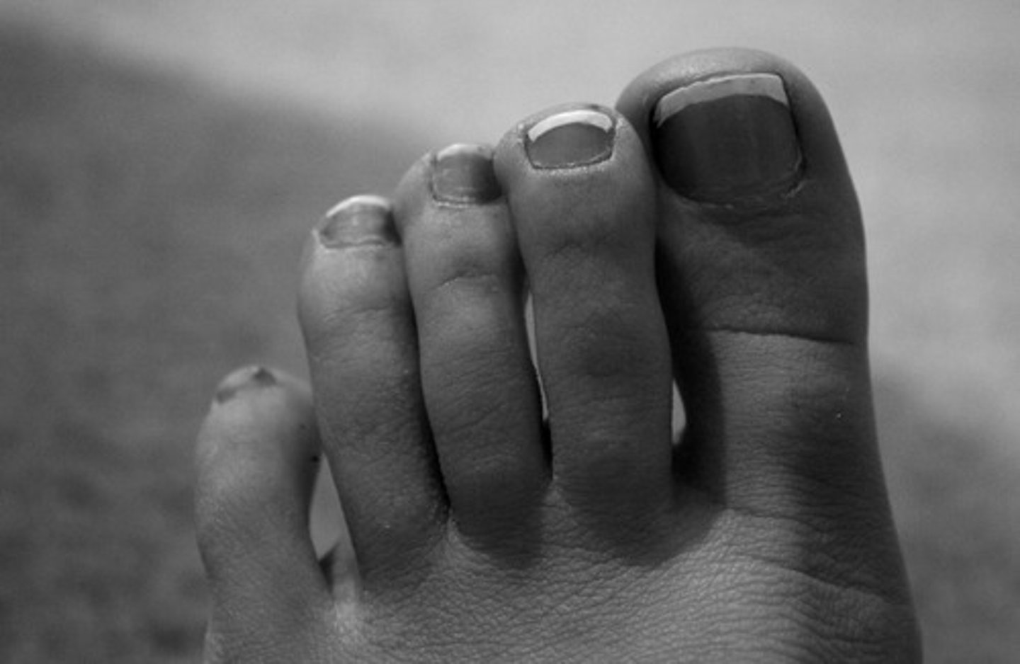 <p>Toes.</p>