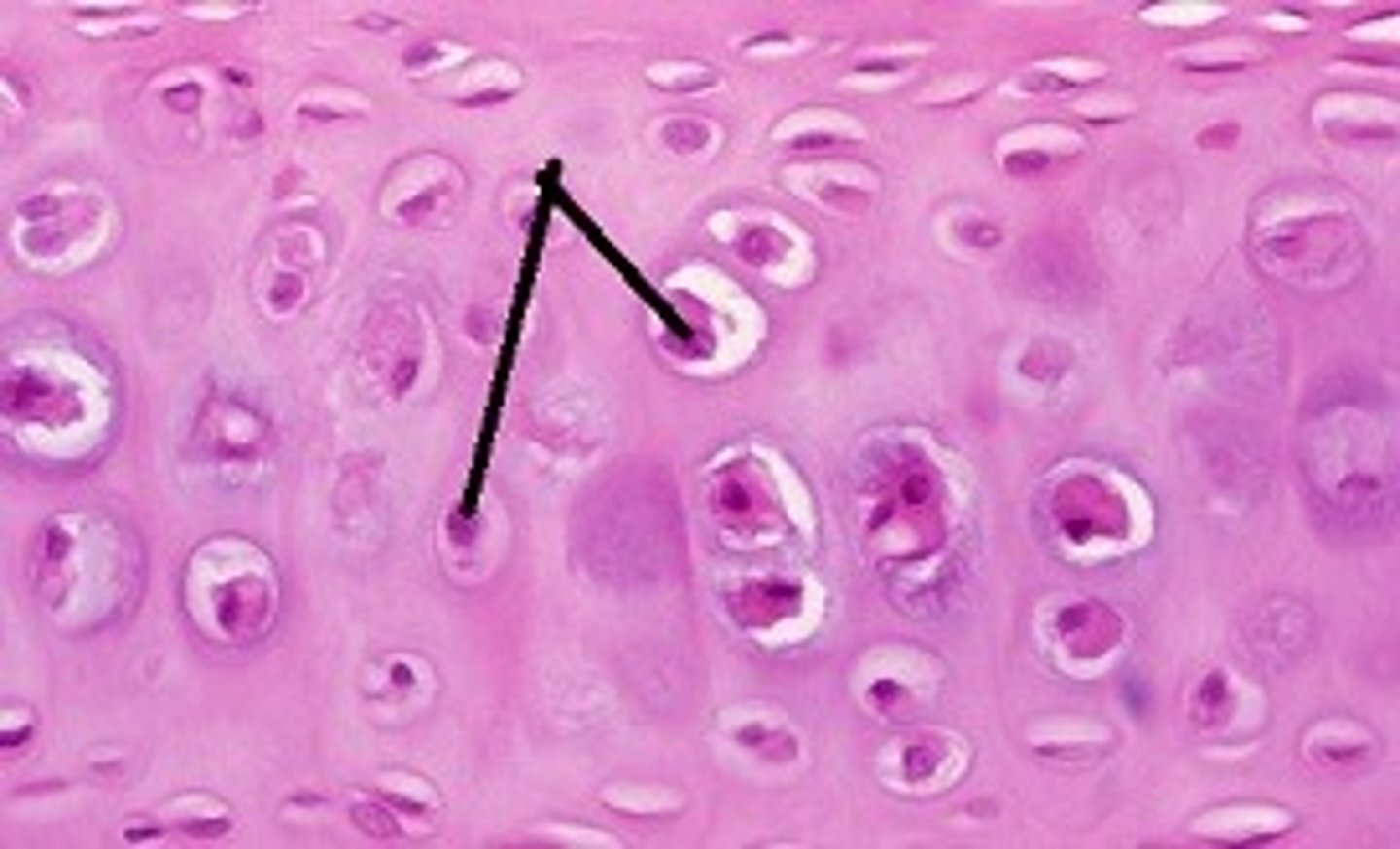 <p>Large and multinucleated</p>