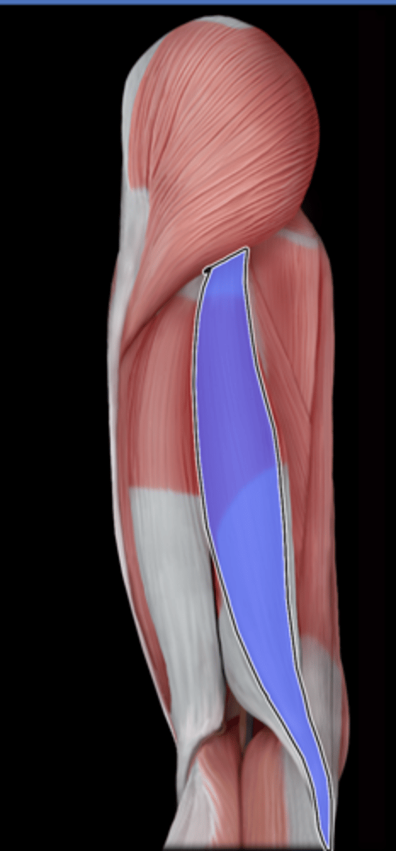 <p>What Muscle Is Highlighted?</p>
