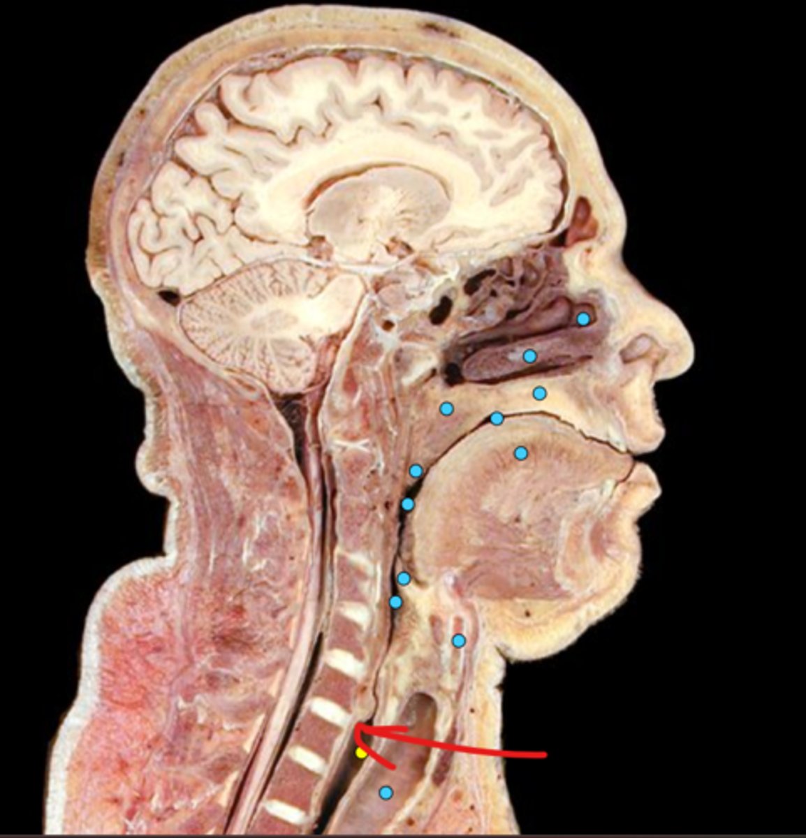 knowt flashcard image