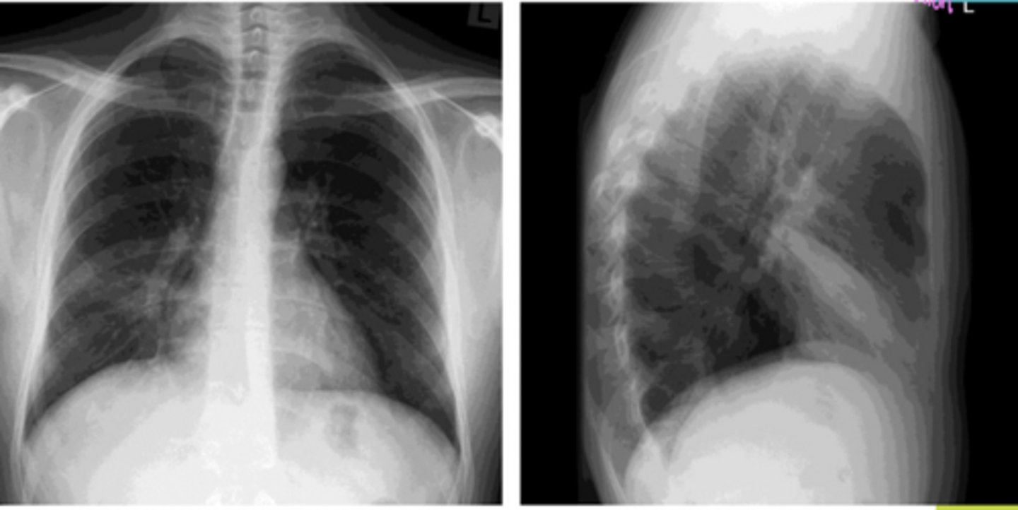 <p>What diagnosis is present?</p>