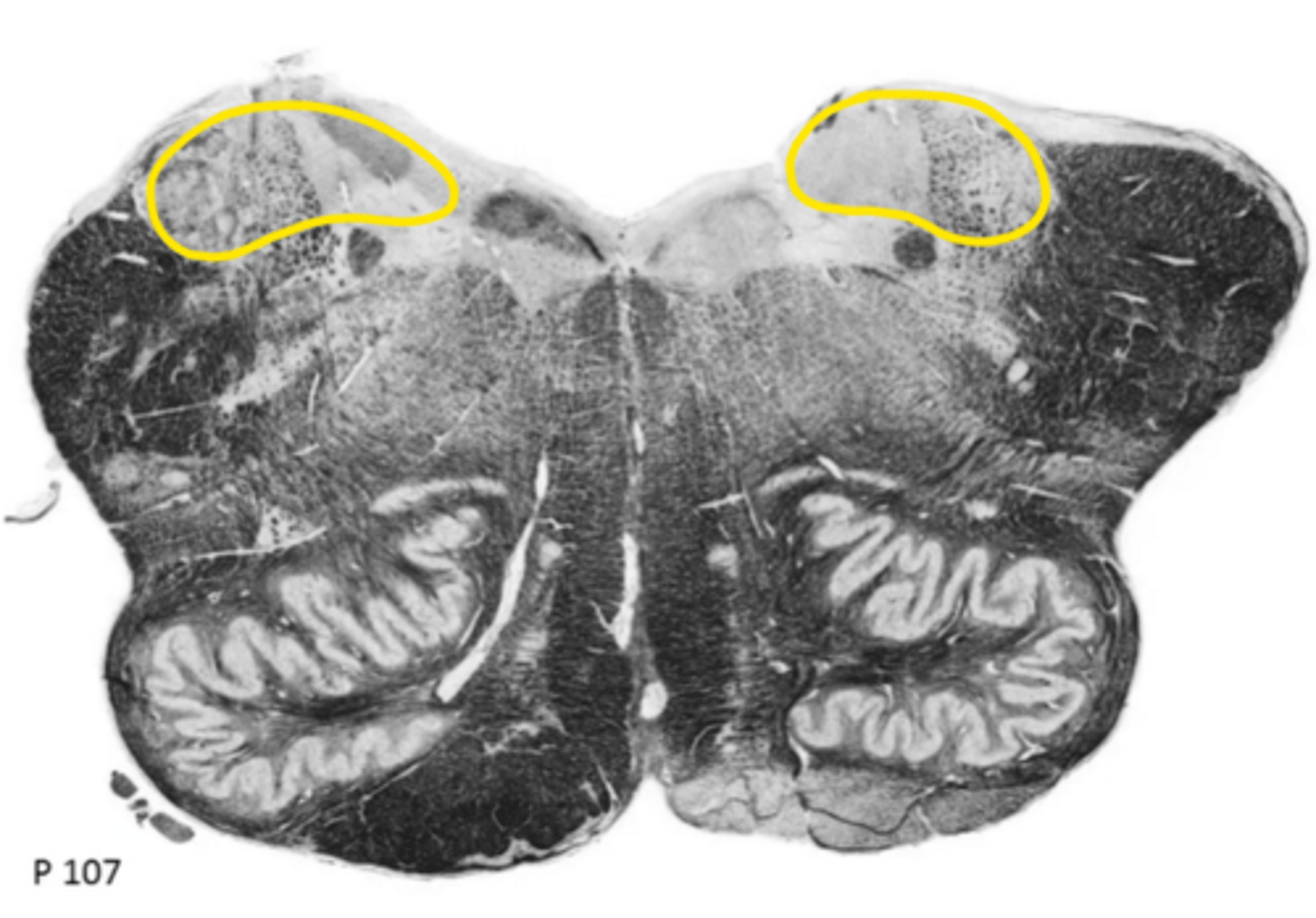 <p>ID the nucleus</p>