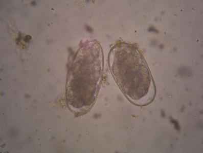 <p><span>This was found in a stool sample of a colicky horse. Name one kind of worm it could be.</span></p>