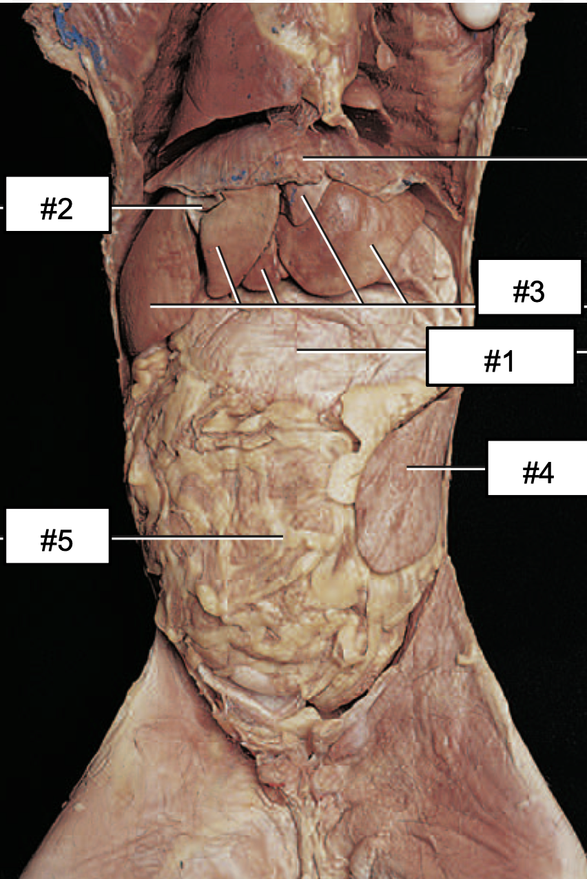 <p>#3?</p>