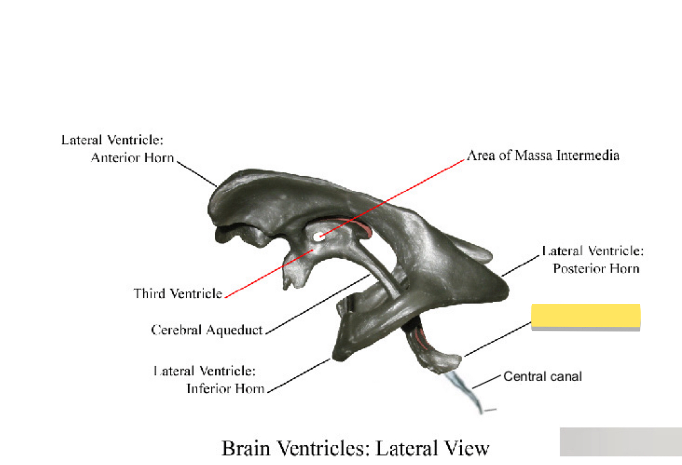<p>Name this brain ventricle </p>