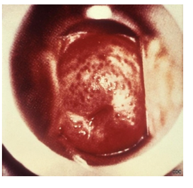 term image