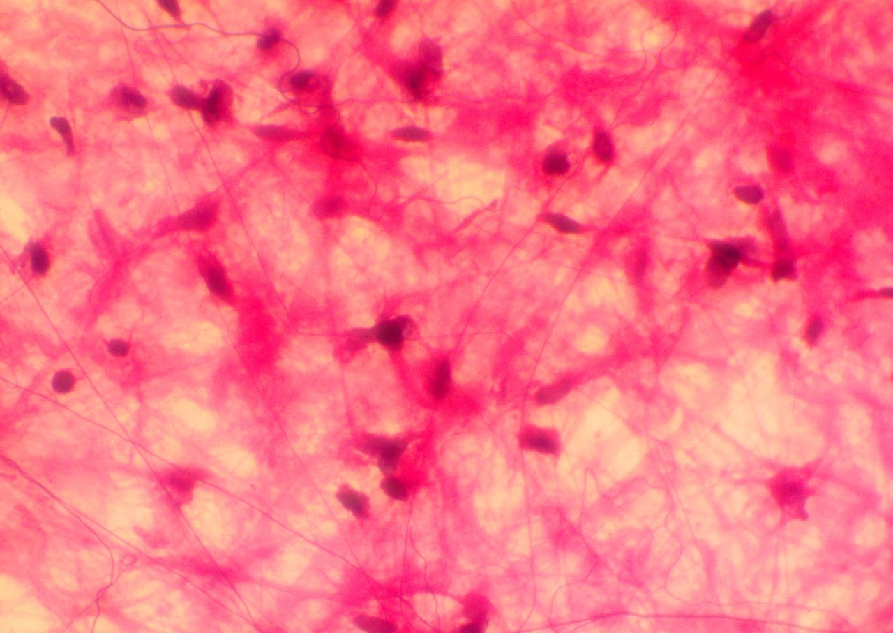 <p><span>Found in the papillary layer of the dermis</span></p>