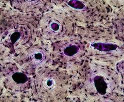 <p>Supporting connective tissue with calcified matrix and collagen fibers.</p>