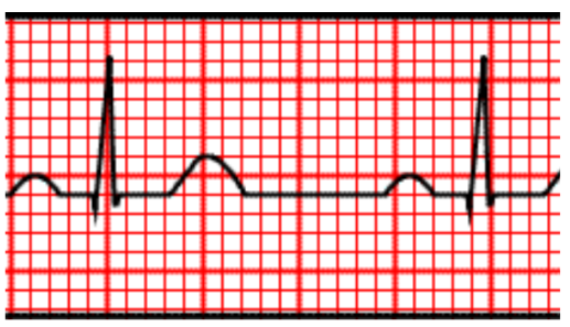 <p> what is the heartrate (19.5 small squares) (round up)</p>