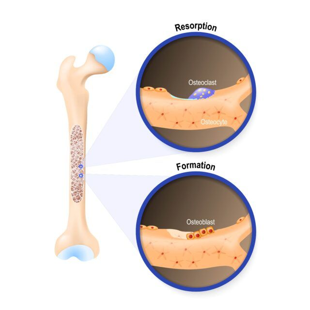 <p><span style="color: blue"><strong>Resorption</strong></span></p>