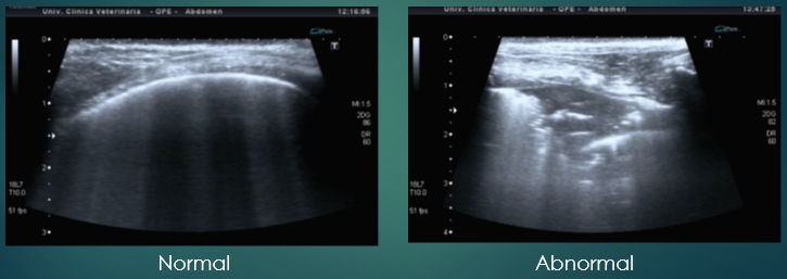 <p>Diagnosis - Ultrasonography </p>