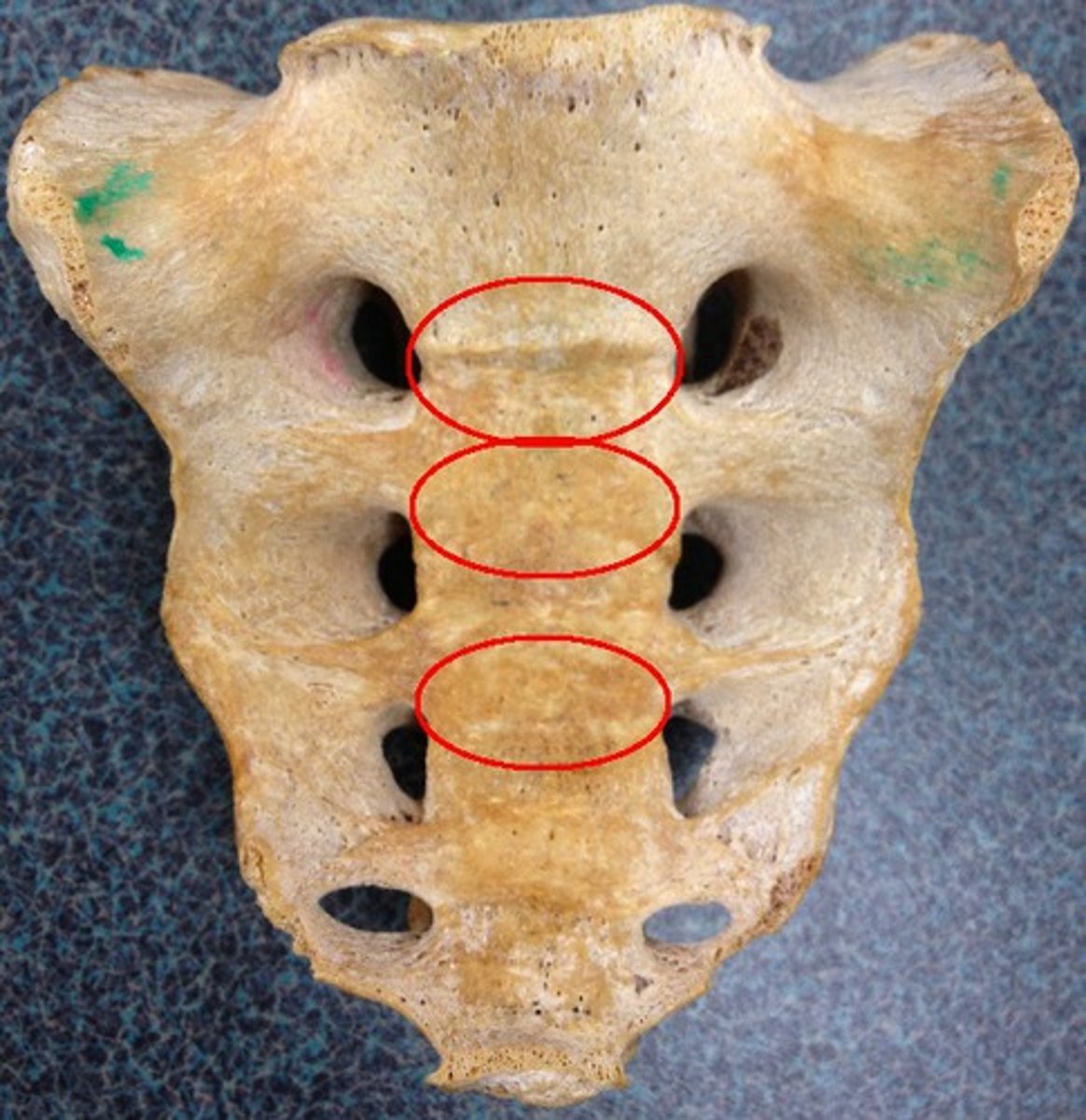 <p>Transverse ridges</p>