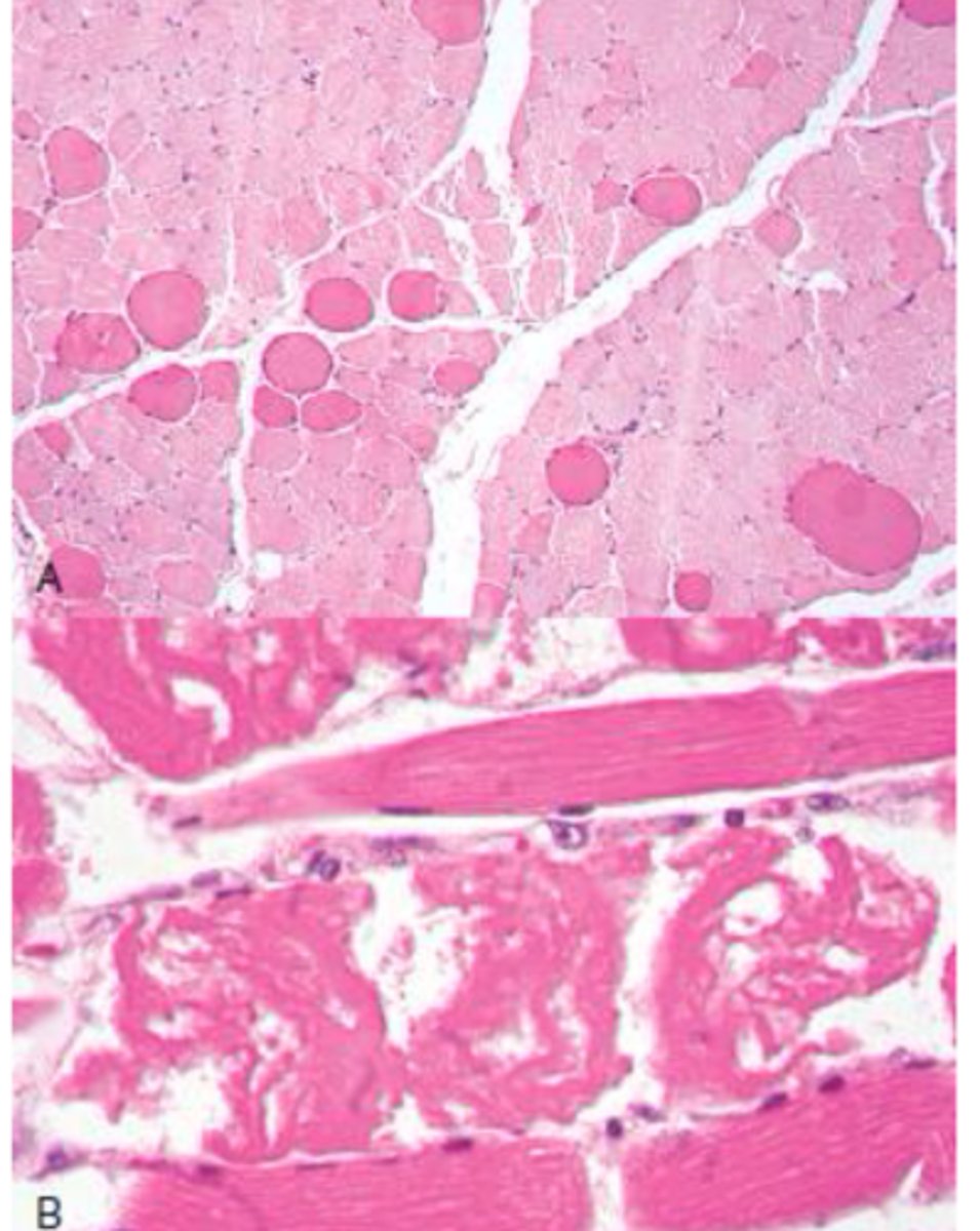 <p>What does Ionophore toxicity do?</p>