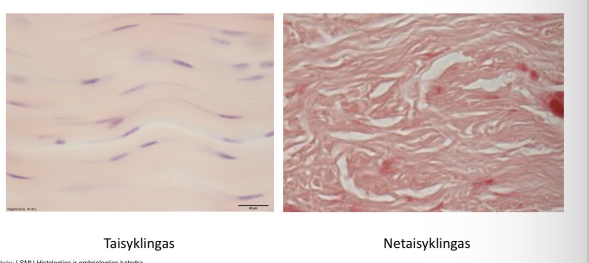 <p>Taisyklingas</p><p>Netaisyklingas</p><ul><li><p>priklauso nuo skaidulu issidestymo</p></li></ul><p></p>