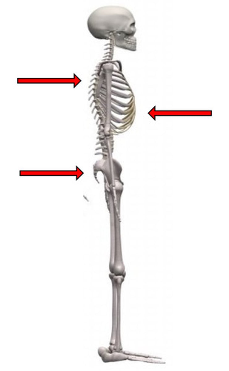 <p>1 posteriorly-directed corrective force</p><p>2 anteriorly-directed stabilizing forces (inferior and superior)</p>