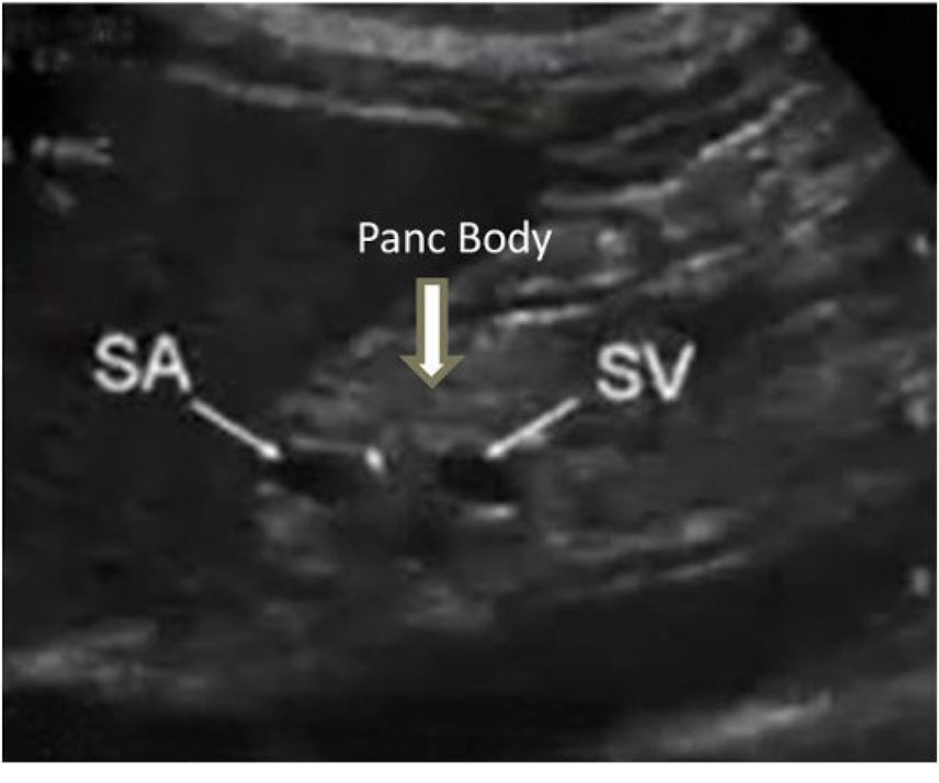 <p>Where was this image taken from? </p>