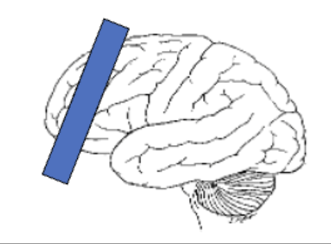 <p>frontal lobe and premotor cortex </p>