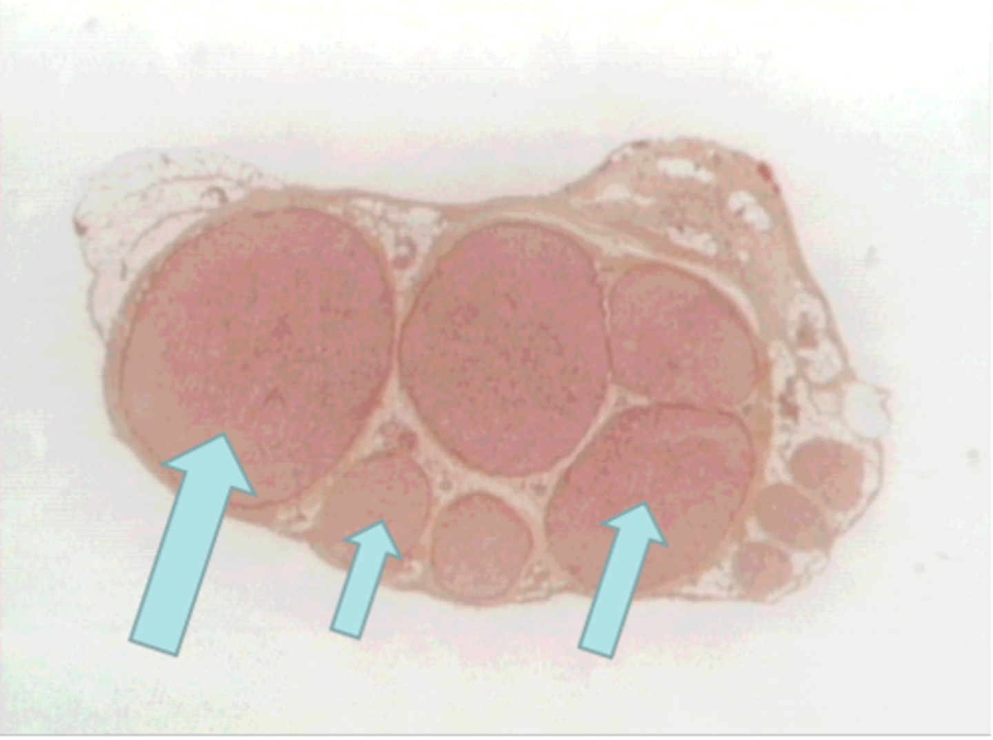 <p>a bundle of nerve fibers within a nerve</p>