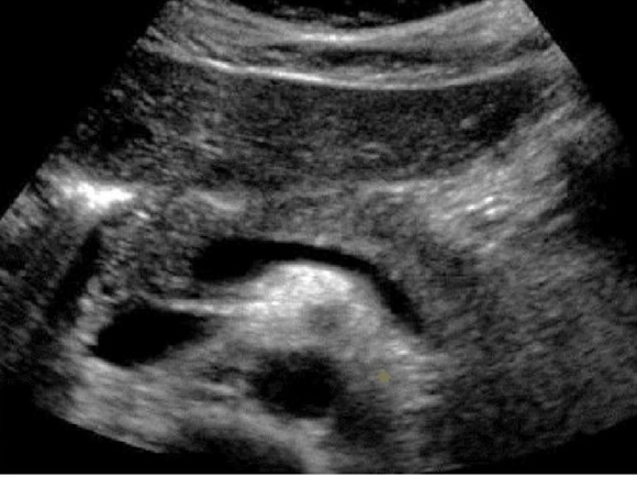 <p>label this image</p>