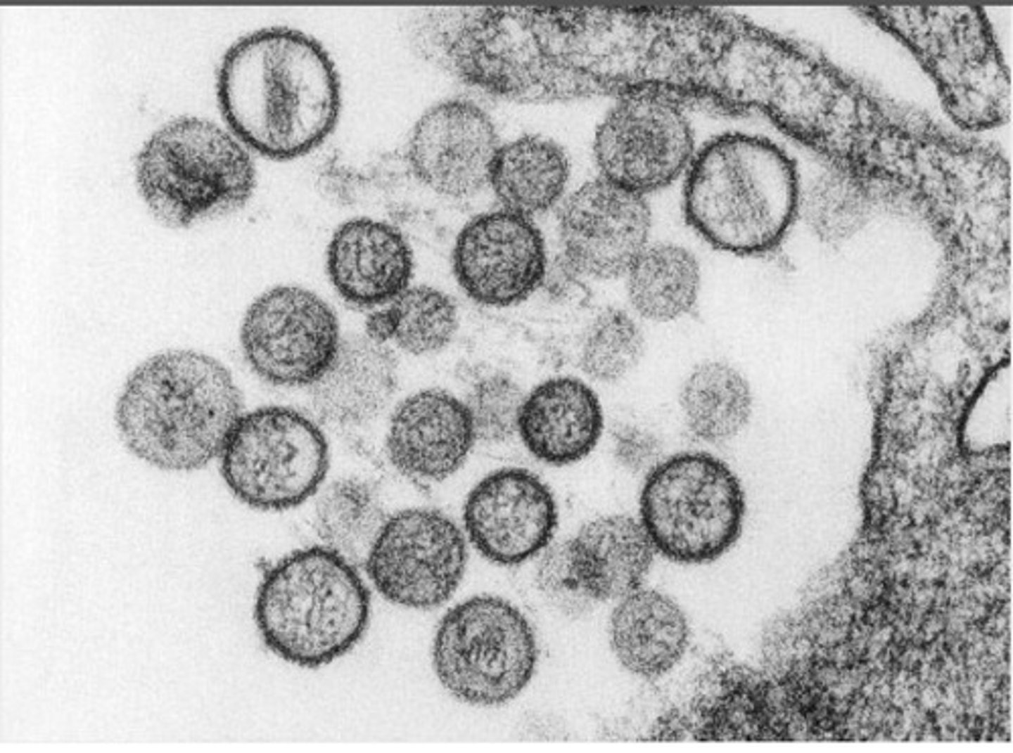 <p>A single stranded enveloped, negative sense RNA virus.</p><p>In the Bunyaviridae family.</p><p>May become infected through contact with rodent urine, saliva or feces.</p><p>Can cause fatal diseases such as hantavirus hemorrhagic fever with renal syndrome.</p>