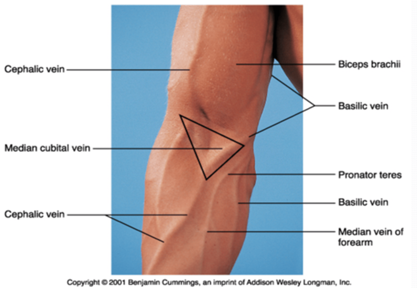 <p>flexors (pronator teres m.)</p>