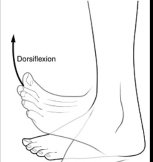 <p>Which movement is shown in the picture?</p>