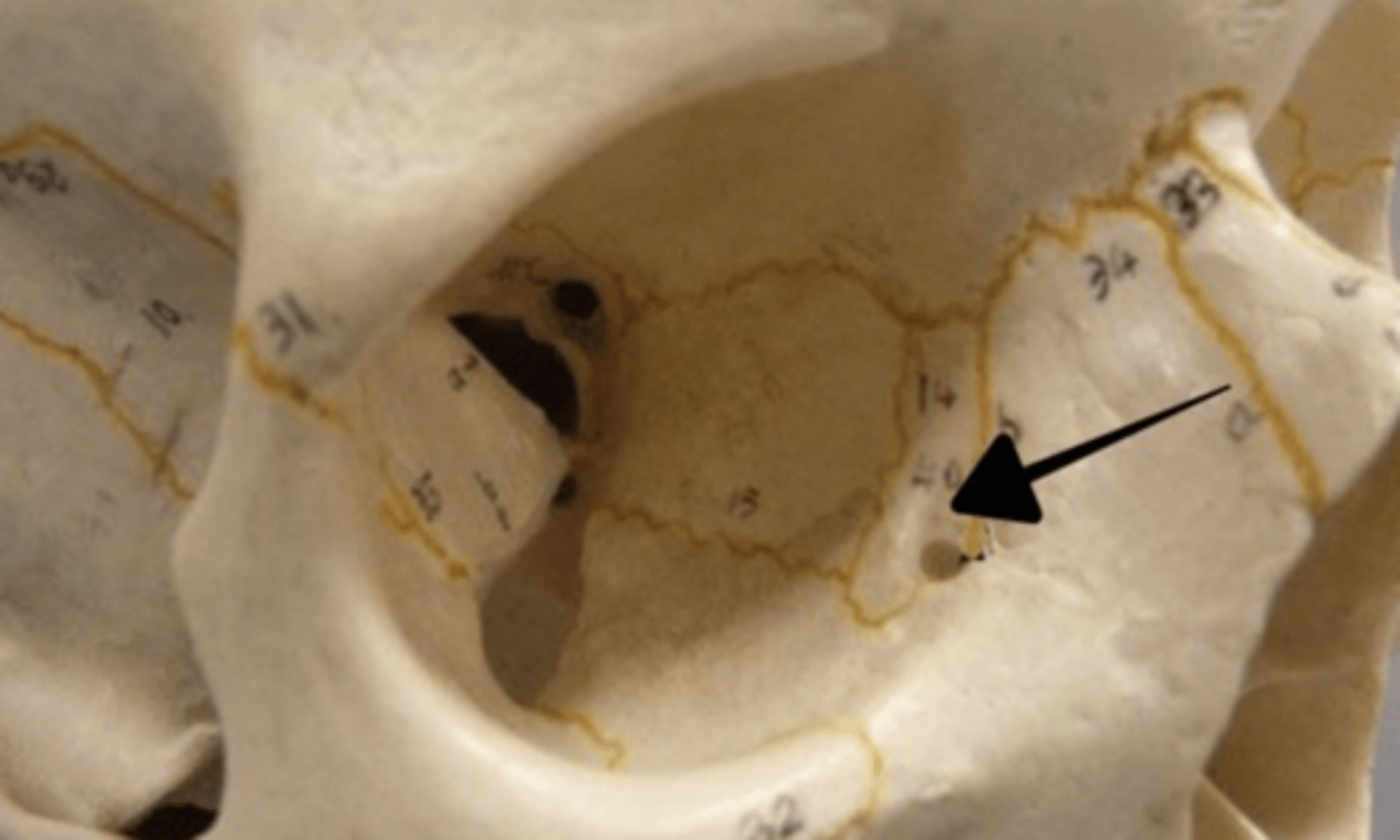 <p>lacrimal bone</p>