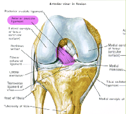 <ul><li><p>Origin on anterior intercondylar eminence of the tibia to insert into medial side of lateral femoral condyle. </p></li><li><p>Runs superior-lateral-posterior direction (SLP)</p></li><li><p>Lies in the space between the fibrous and synovial layers of the capsule. Thus it is intracapsular, but extrasynovial. </p></li><li><p>The ACL has two main bundles: anteromedial and posterolateral </p></li></ul><p></p>