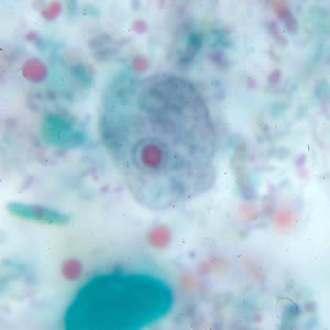 <ul><li><p>5-12 um</p></li><li><p>prominent “blot-like” karyosome</p></li><li><p>no peripheral chromatin</p></li></ul><p></p>