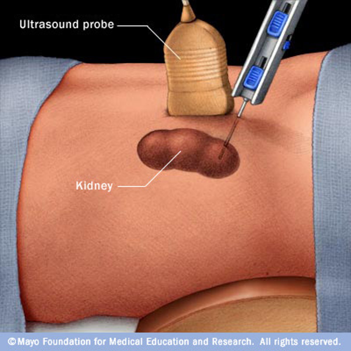 <p><strong><span class="bgB">Evaluates cellular function</span></strong>.</p><p></p><p>Post procedure care: pressure to site, bedrest following test, no heavy lifting</p>