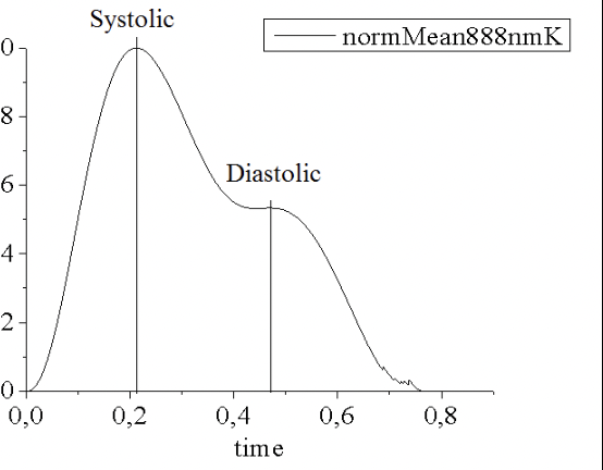 <p>The first part of the cardiac cycle where the ventricles are contracting </p>