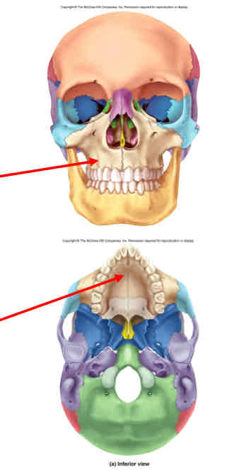 term image
