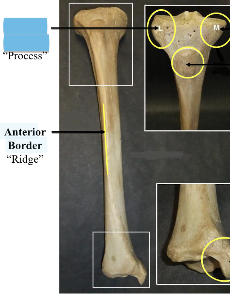 <p>Anterior Border </p>