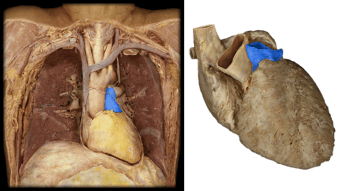<p>Identify this vessel.</p>