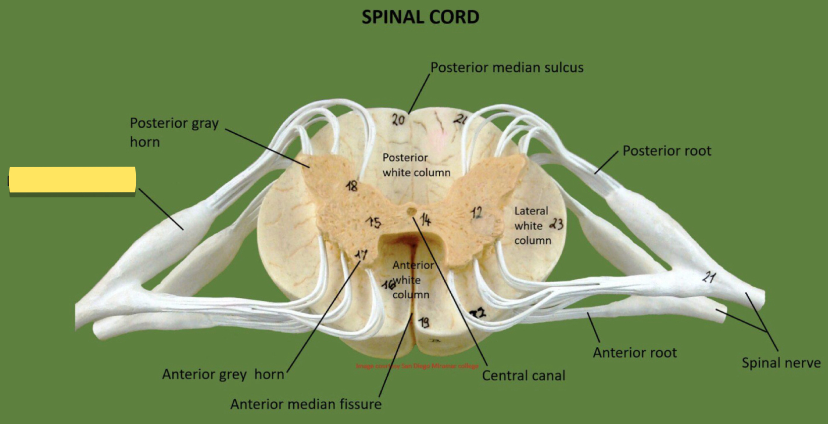 <p>Name this spinal cord part</p>