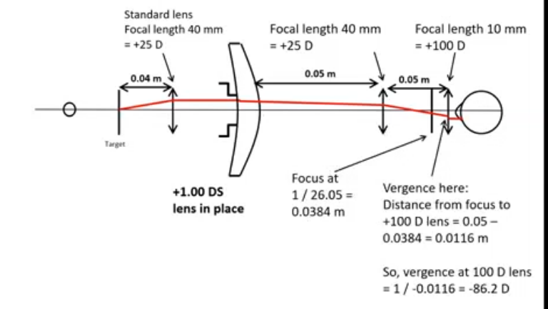 <p>light converges from the lens until pbjective lens with a distance of 0.05m apart </p><p>vergence before hitting the objective lens</p><p>1/1 = 1m </p><p>1-0.05 = 0.95m </p><p>1/0.95 = +1.05 D </p><p>vergence after hitting objective lens = 0.95+25 = 26.05</p><p>forms a focus at 1/26.05 = 0.0384m </p><p>vergence at eyepiece lens: distance from focus to +100 D len = 0.05 -0.0384 = 0.0116m </p><p>so vergence at 100 D lens 1/- 0.0116 = -86.2 D </p><p>vergence after 100 D lens : -86.2 +100 = +13.79 D </p><p>1/13,79 = +0.0725 m </p><p>0.0725 -0.01 ( countering in distance between cornea and lens) = 0.0625 </p><p>1/0.0625 </p><p>+16D </p><p>will see bluured image </p>