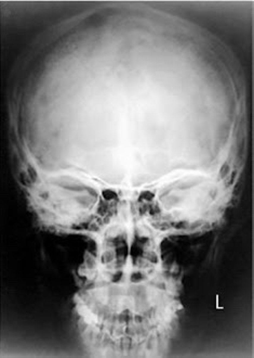 <p>What position/projection? (patient is prone on the x-ray table)</p>