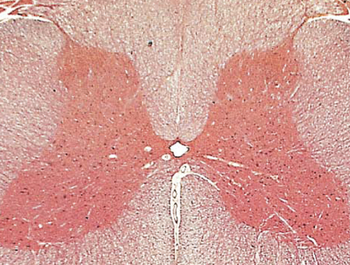 <p>what is the red butterfly called</p>