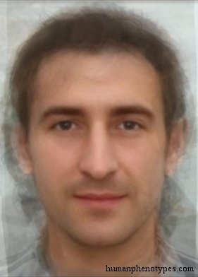 <p>Identify this Phenotype</p>