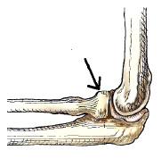 What anatomy is indicated by the arrow in this figure?