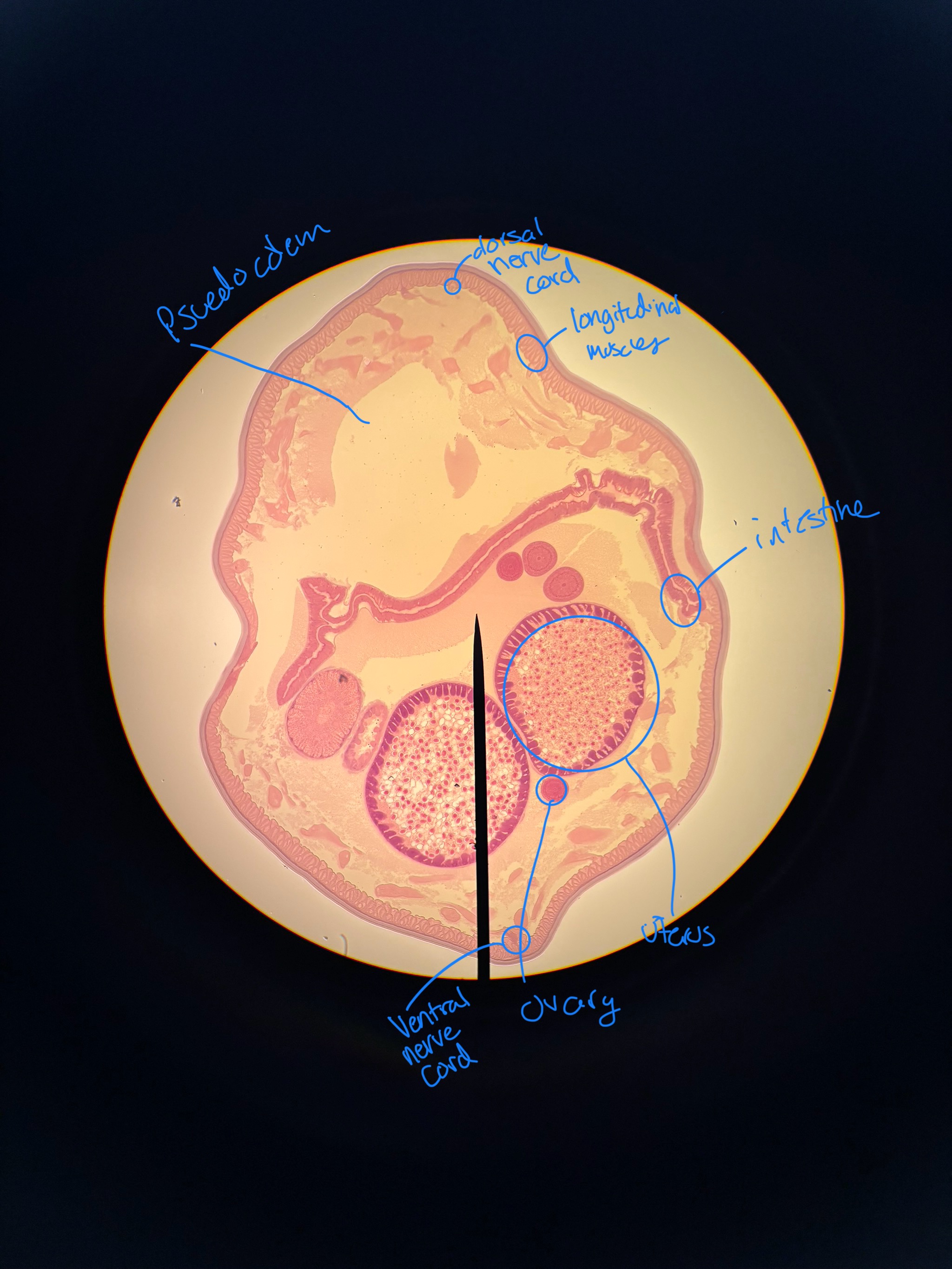 <p>refer to image. </p>