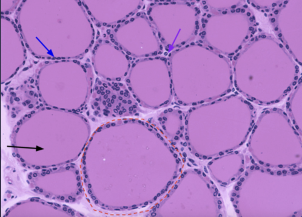 <p>What is the red circle?</p>