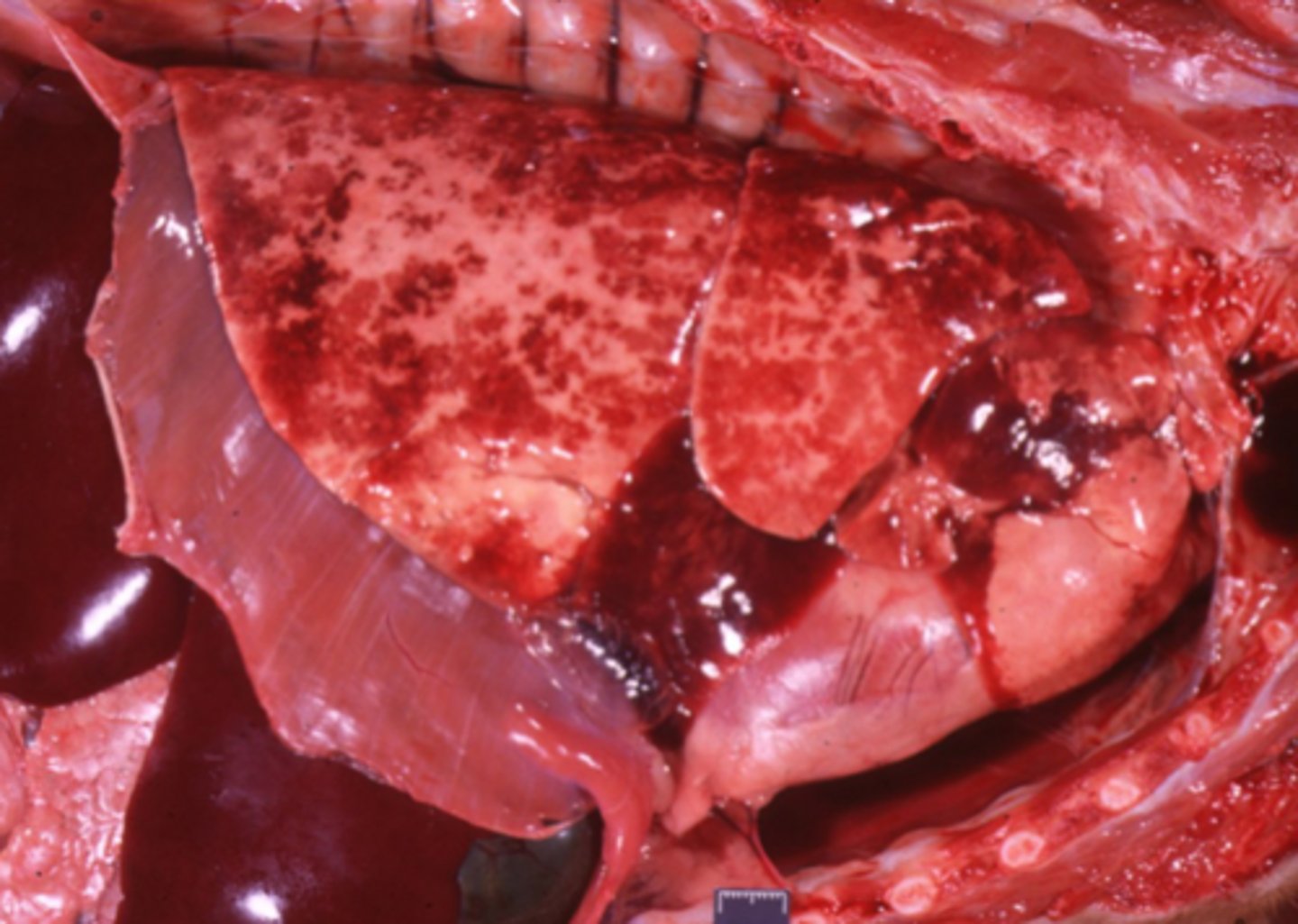 <p>Canine Distemper with secondary bacterial infection is the classic example of a ____[type of pneumonia]______.</p><p>(she wants you to be able to describe the lesions associated with this type of pneumonia, as well as WHY they show up why they do... previous lecture stuff I believe)</p>