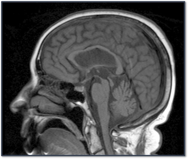 <ul><li><p>The Penguin Sign</p></li></ul><p></p>