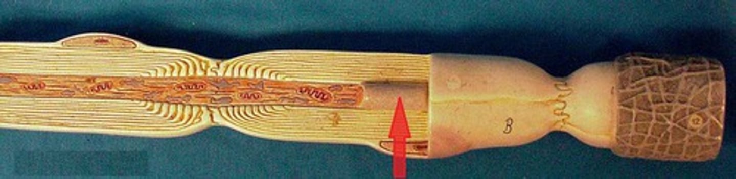 <p>plasma membrane of axon</p>