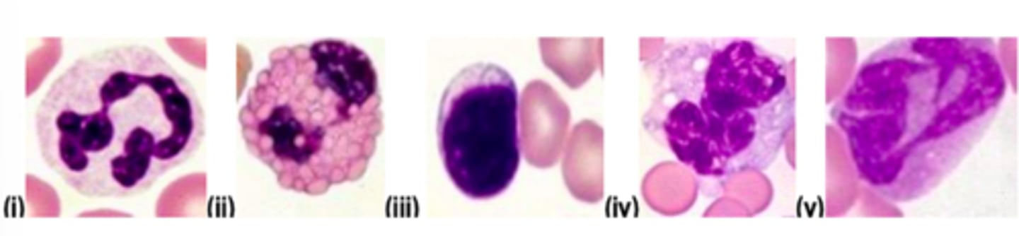 <p>Which of the cells illustrated in plate 1 is most likely to be increased in the blood of an animal with chronic lymphocytic leukaemia?</p>