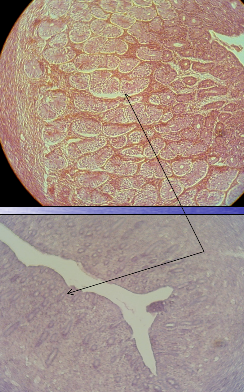 <p>What structures are being indicated by the arrows?</p><p>*Hint: These uterine secretory units are extremely sensitive to the effects of estrogen and progesterone.</p>
