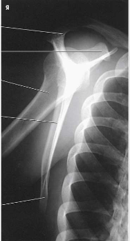 <p>What type of projection, position and anatomy is this?</p>